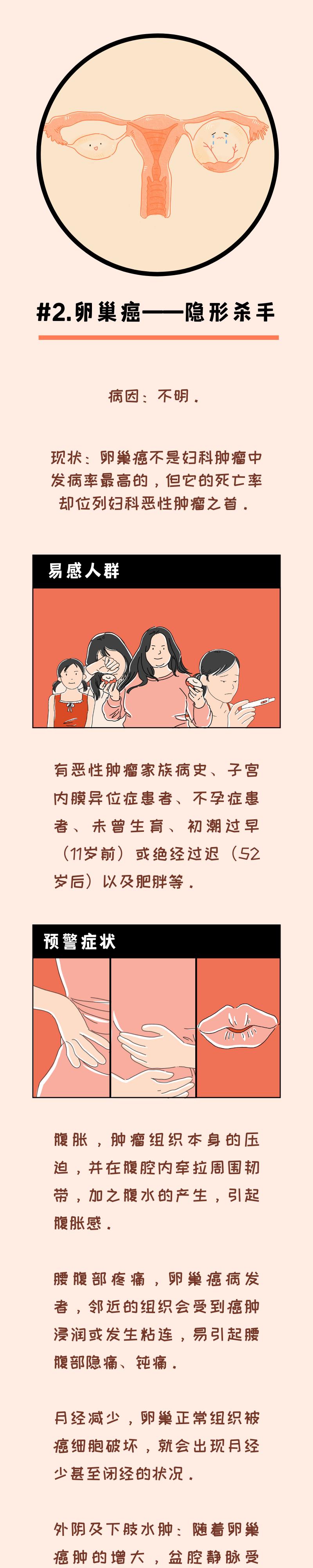 女性3大惡性腫瘤的常見信號發現一個及時就醫