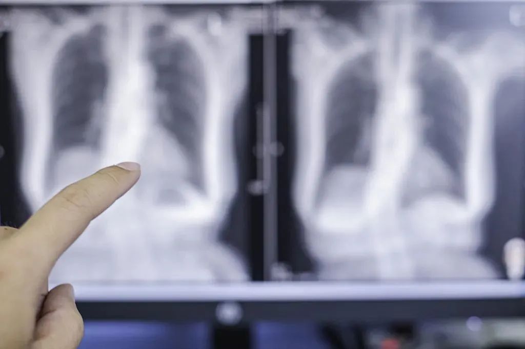 乳腺红外线检测什么终究是“错付”了...这4个体检项目没必要，这几项才是最该做的！_https://www.jmylbn.com_新闻资讯_第2张