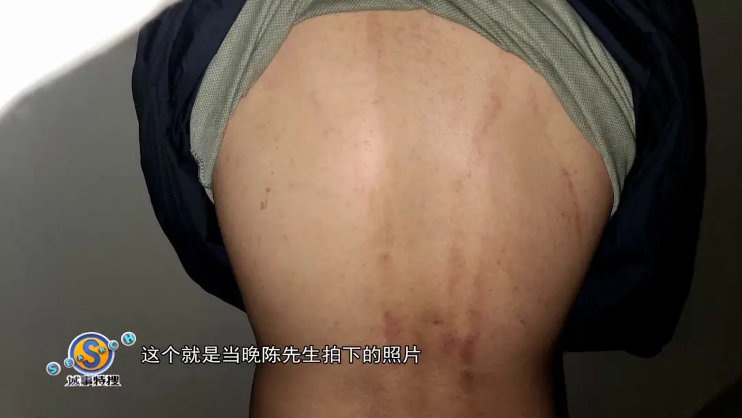 男人后背抓痕样式图片图片