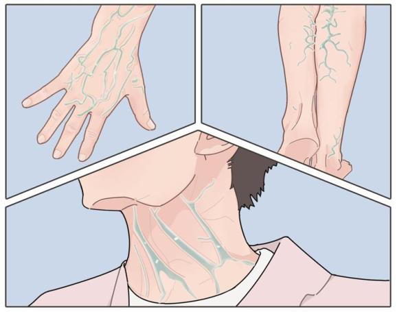 下体这个部位有青筋竟是大病前兆