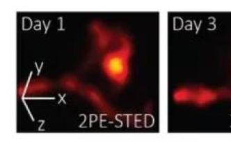 新3D“超分辨率”成像技术，揭示小鼠大脑微小结构