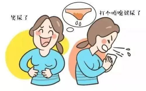 女性尿失禁尴尬