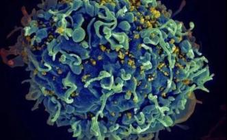CMV疫苗，会成为人类感染艾滋的终结者吗？