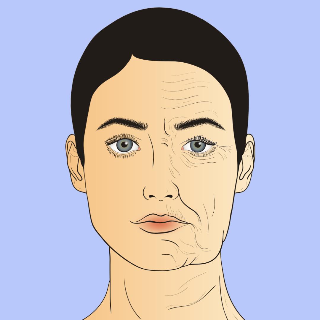 脸上出现4个信号,说明你正在衰老