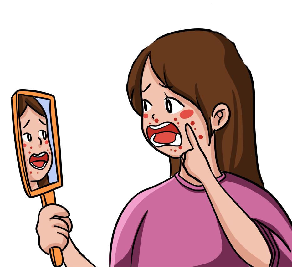 【市中医|科普】春季过敏自救指南