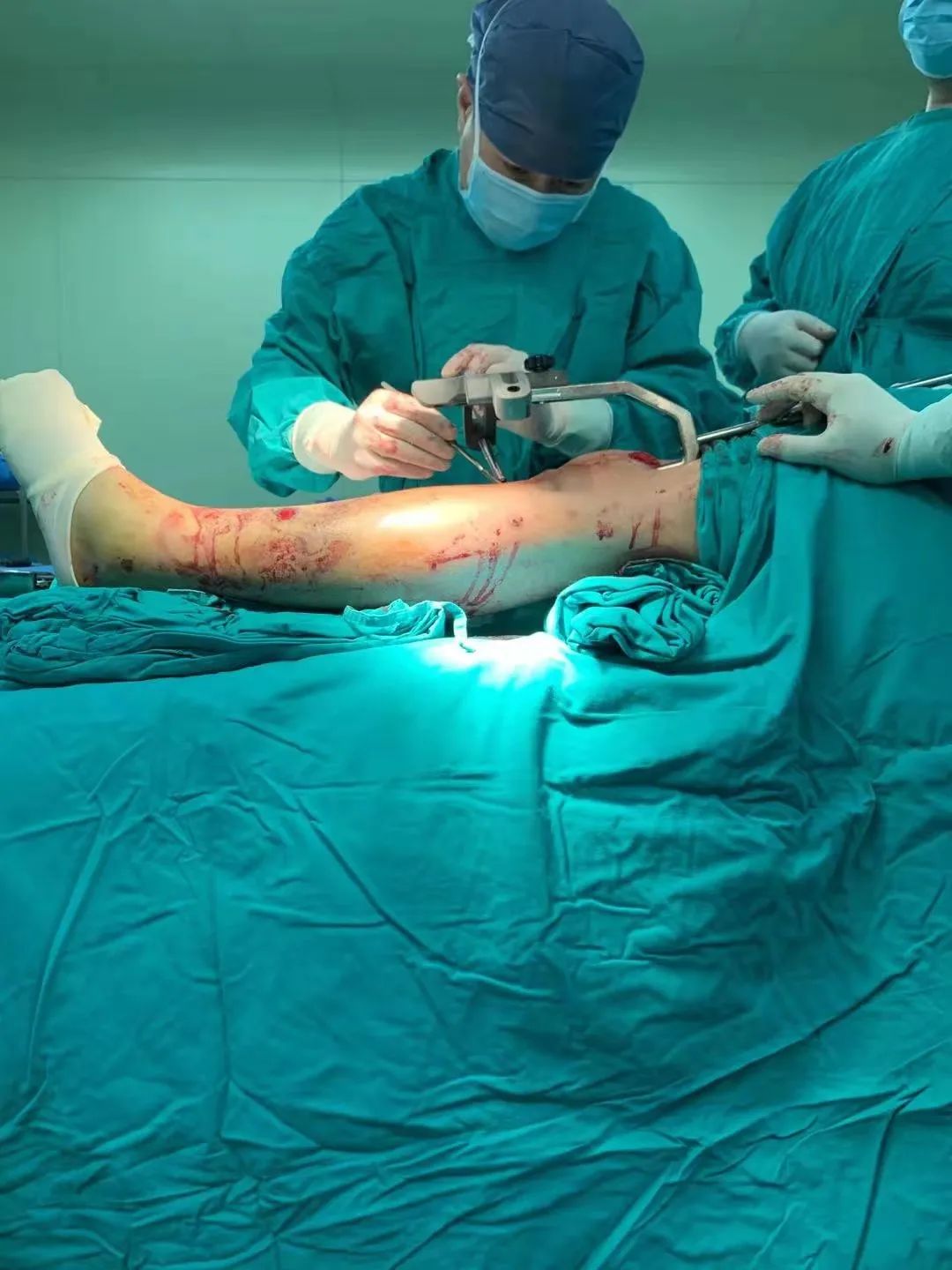 我还很年轻 不想后半辈子都一瘸一拐的 澎湃新闻 The Paper