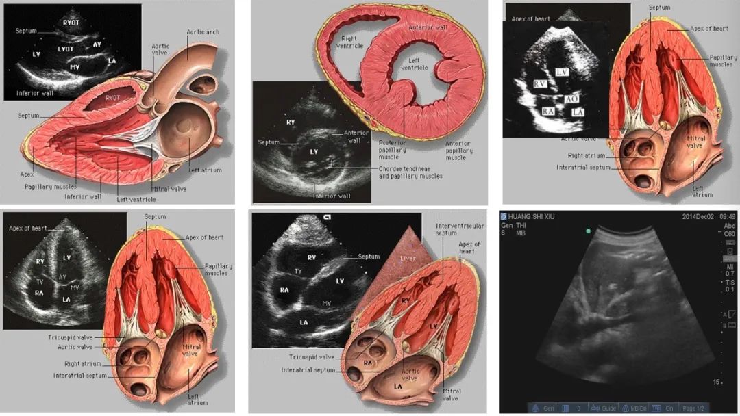 transthoracic echo)快速评估心脏功能容量状态和容量反应性 …超声