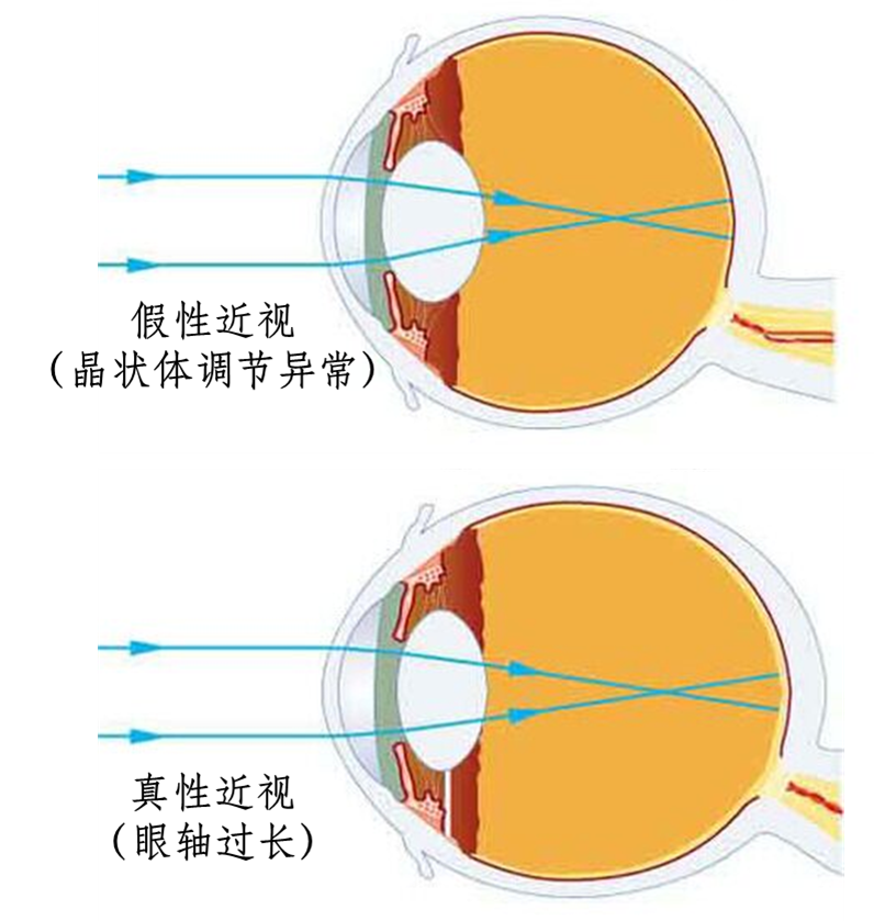 孩子天生都是"远视眼","远视储备"应该这样来珍惜