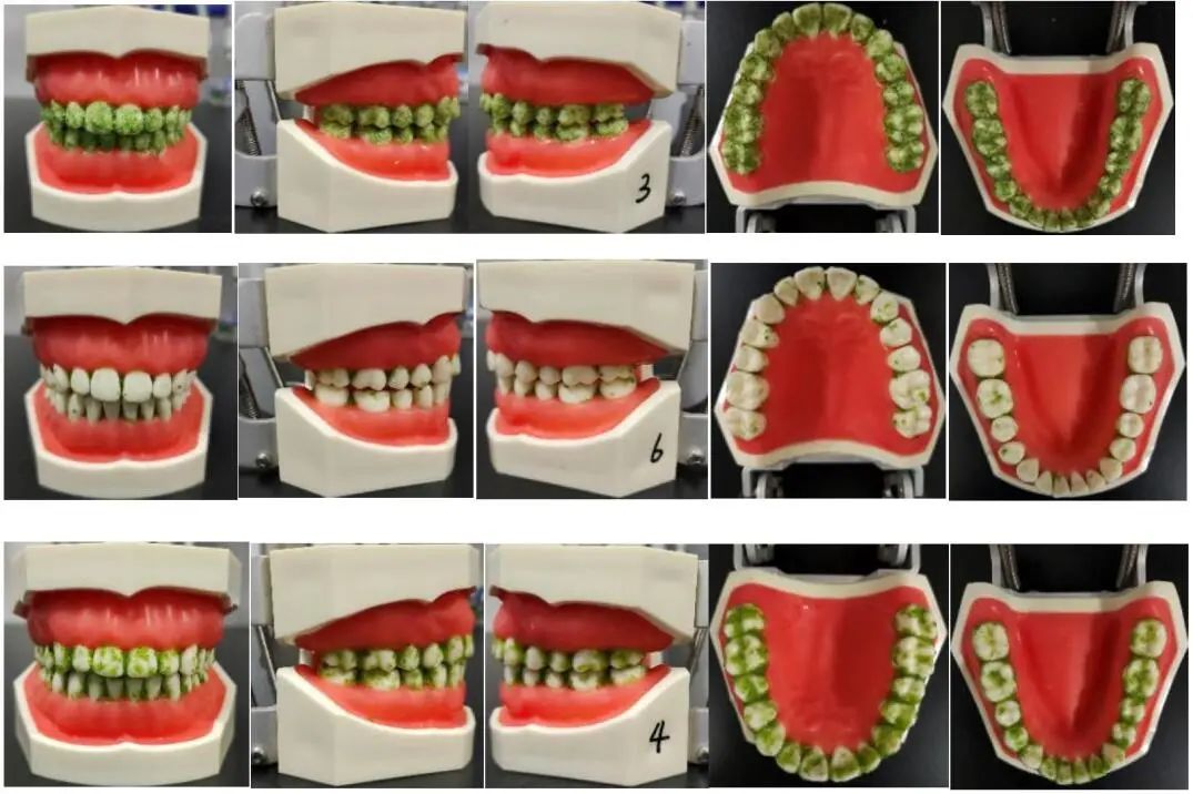 电动牙刷哪家强中国消费者协会25款电动牙刷比较试验