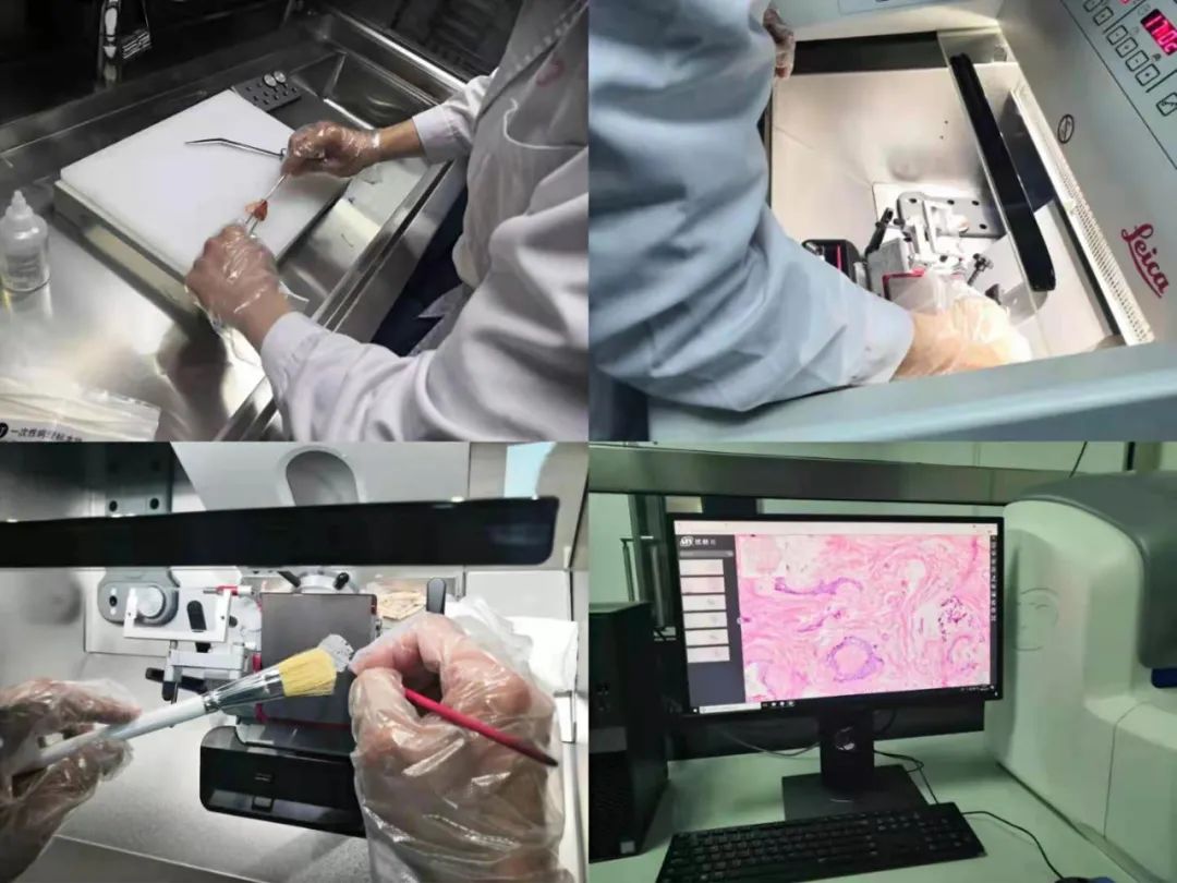 也许很多人对术中冰冻快速病理检查有很多疑问,那先让我们来了解一下
