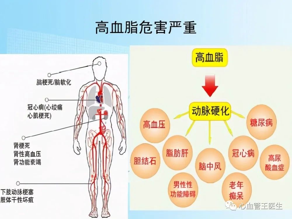 高血脂患者和心血管专家门诊对话,如何控制血脂?