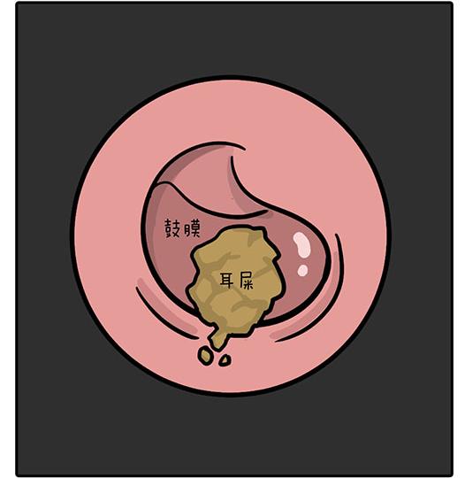 耳屎宝宝好处多闲来无事不要掏