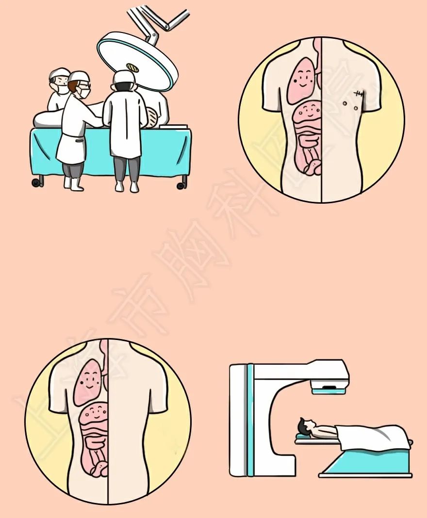 放疗卡通图片
