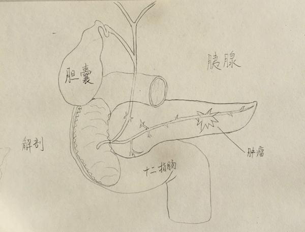 胰腺素描图图片