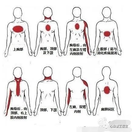 冠心病是怎么诊断的?