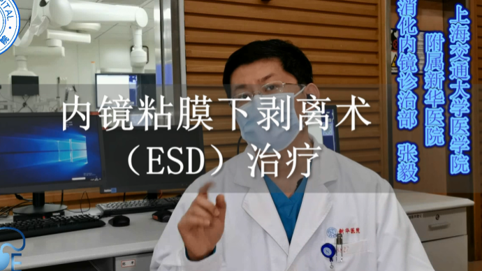 内镜粘膜下剥离术（ESD）治疗