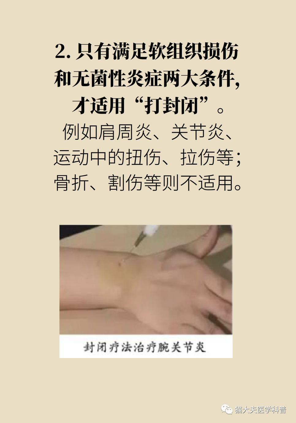 "打针一时爽,后患大无穷"丨封闭针是潘多拉魔盒?