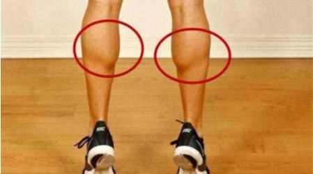 大腿肌肉有横向的条坑图片