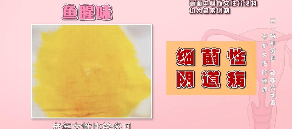 白色乳糜状的分泌物是支原体感染,是一种泌尿生殖系的感染,同时还会有