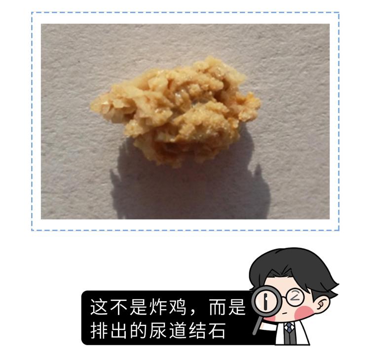 性行为后尿尿刺痛你离这疾病不远了