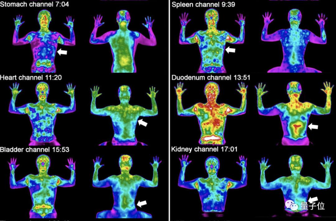 并且,红外线图像显示了被激活器官的清晰形状,例如,心脏和肾脏被黄茶