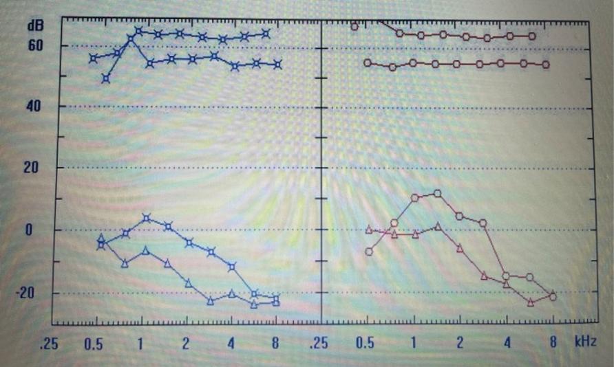 耳声发射图怎么看【华东｜特色诊疗】耳鼻咽喉科：“五种检查”测听力！科学诊断耳背原因_https://www.jmylbn.com_新闻资讯_第8张