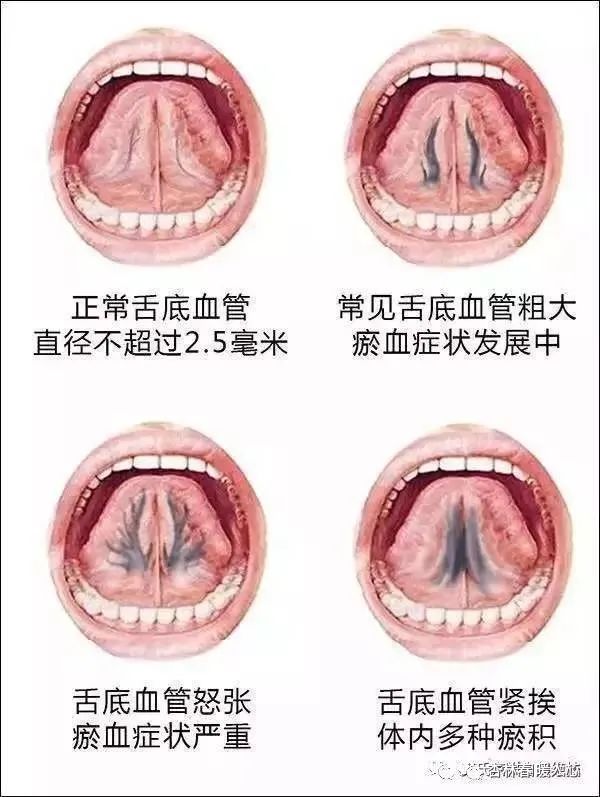 浦南医院中医科"舌针"特色