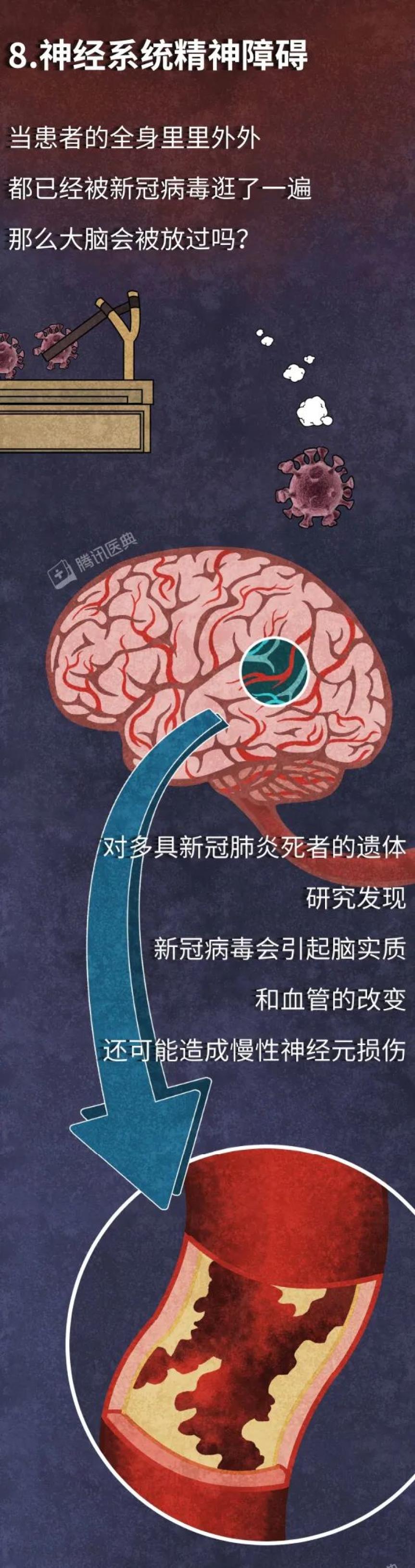 慎点新冠最全后遗症曝光