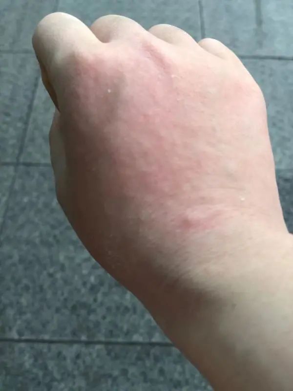 高温天,长宁这些医护人员戴着口罩,手套,穿着隔离衣