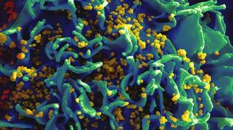 新型艾滋病疫苗在美国研发成功，97%受试者产生抗体