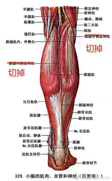 丁香园 称,该手术施行后,常见并发症包括:小腿肌肉力量变弱,小腿妨Ζ