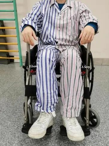 健康脑卒中了该如何选择合适的轮椅