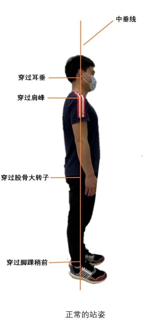 含胸驼背的上交叉综合征