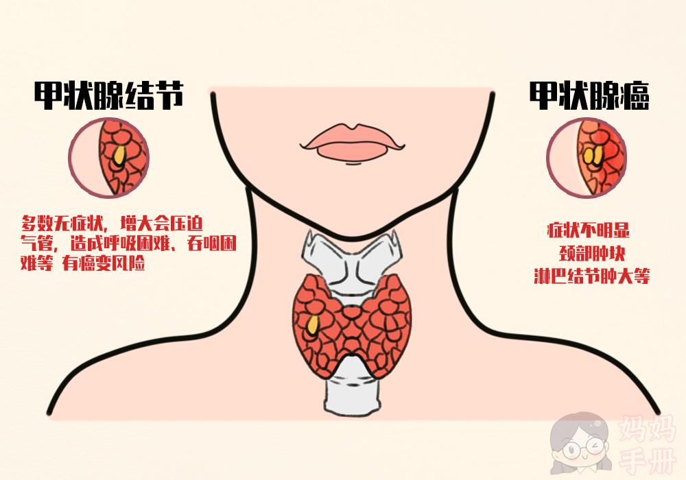 长期患甲状腺疾病会引发或加重心脏病,如甲亢会引起窦性心动过速和心