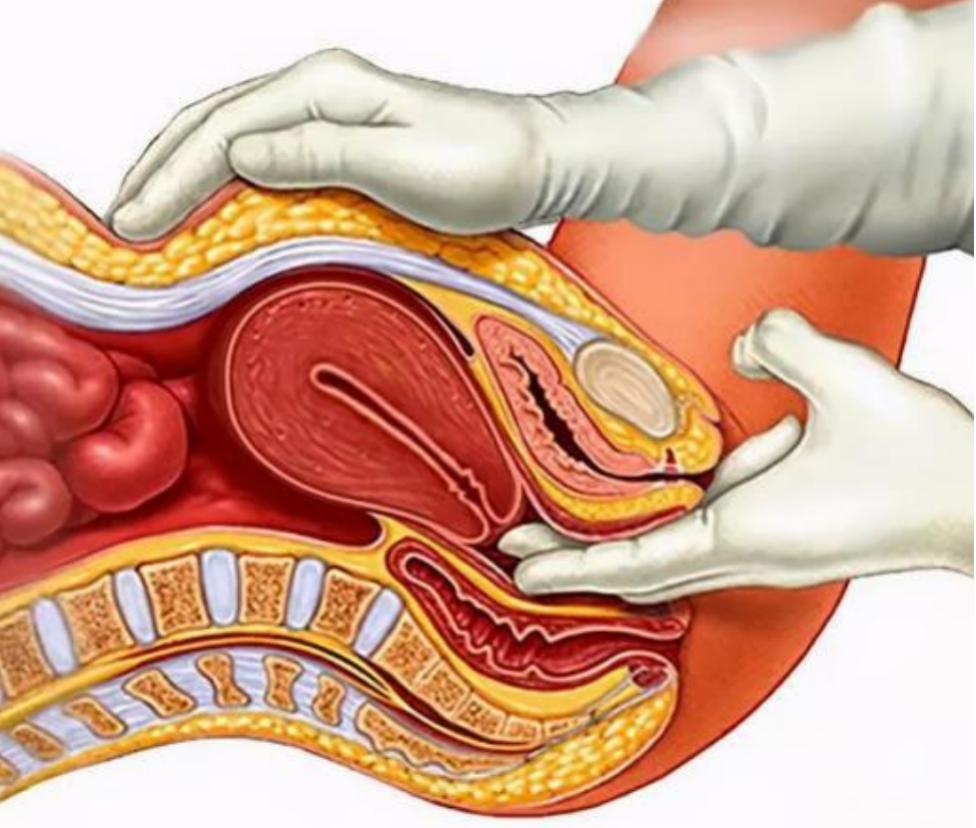 女婴儿尿道口囊肿图片图片