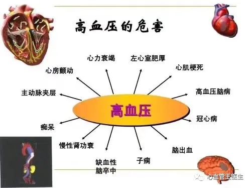 高血压必须知道的10件事