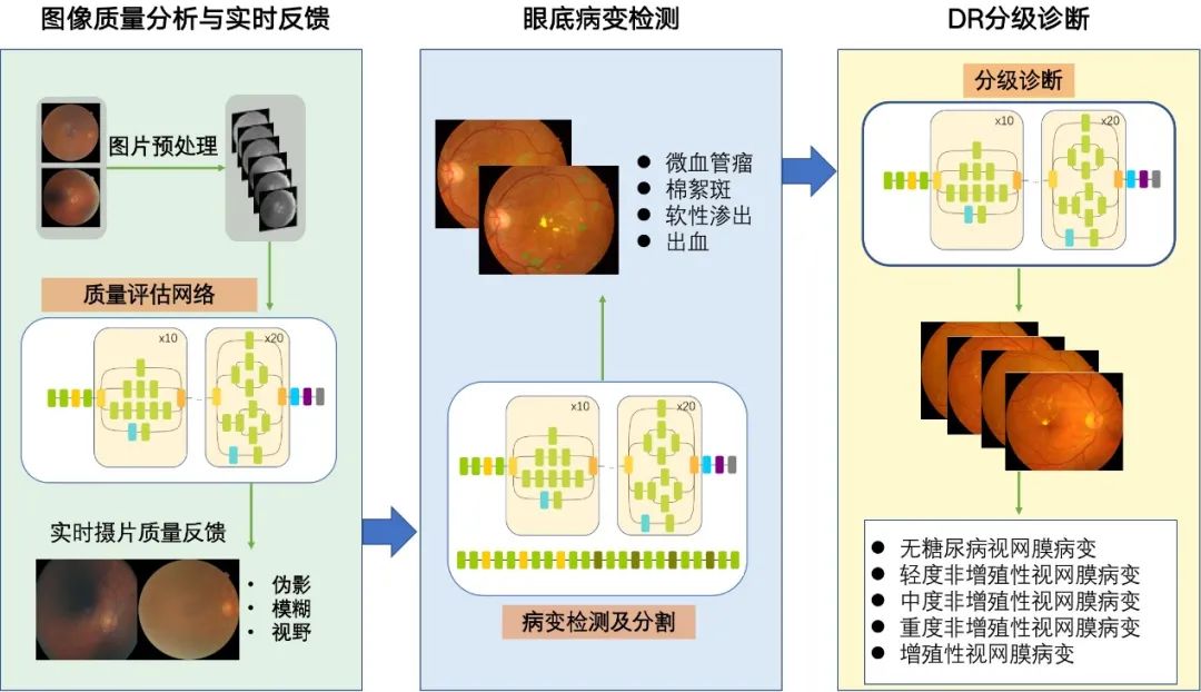 六院新闻贾伟平教授团队研发人工智能系统deepdr精准识别糖尿病视网膜