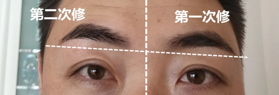 水碾河找有5年自修经验的我最后问个问题:龙子的挑眉肌到底在左还是右