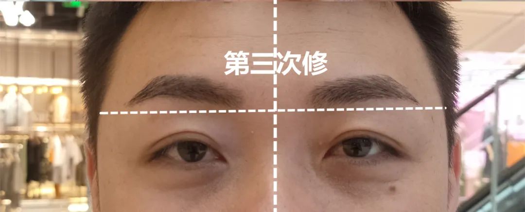 水碾河找有5年自修经验的我最后问个问题:龙子的挑眉肌到底在左还是右