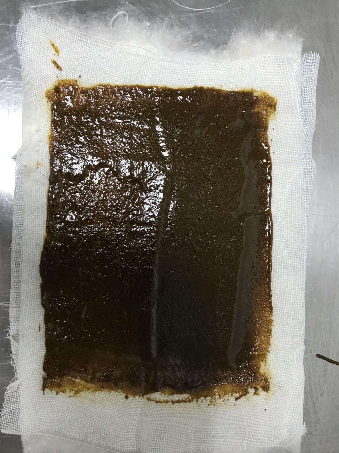 我院中医外科以外敷膏药治疗乳汁淤积,其具有清热解毒,消肿止痛,散瘀