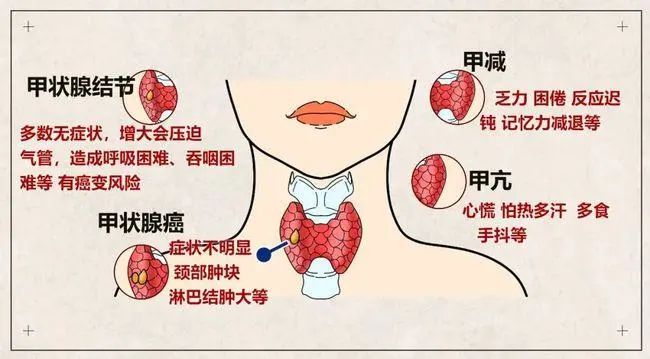 有什麼副作用嗎?最近體檢發現甲狀腺結節了,我該怎麼辦?