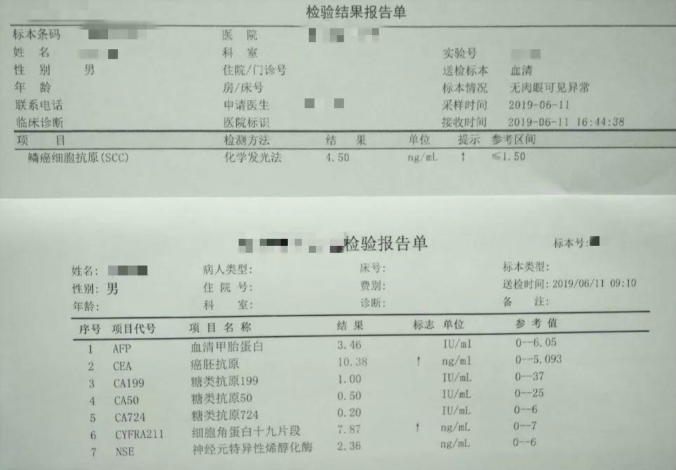 7萬u/l升高:胰腺癌的首選腫瘤標誌物;可見於急性胰腺炎,急性肝炎,膽囊