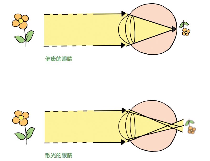 愛眯眼睛點進來看看是不是散光