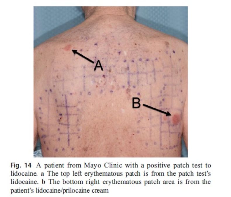 皮肤修复周期是多少天 739.jpg