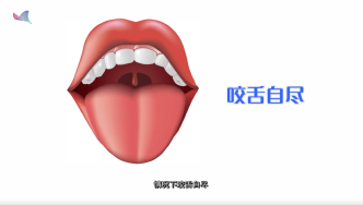 咬舌真的能自尽吗？