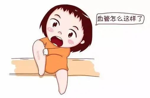 血栓泵是什么【鑫医话健康】生娃，为什么容易“静脉栓塞”？_https://www.jmylbn.com_新闻资讯_第1张