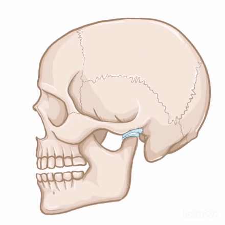 但,当你想拿出灯泡时,灯泡卡在嘴里,把滑动的路堵住了,关节无法充分