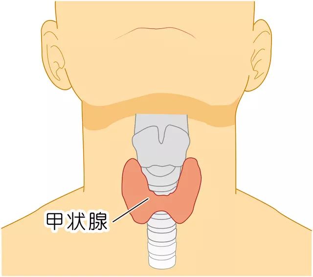 儿童甲状腺图片和症状图片