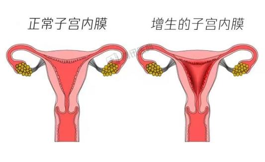 子宫里的这层膜薄了难怀孕厚了易致癌