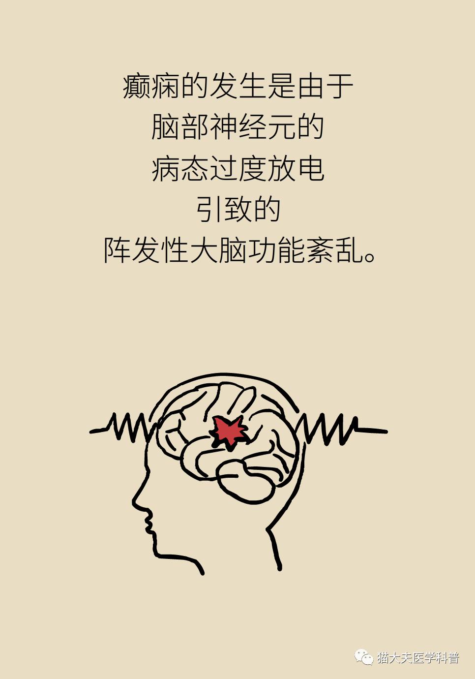 癫痫是不治之症这些治疗方法很有效